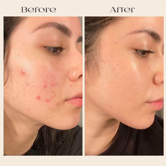 Customer skin appearance comparison